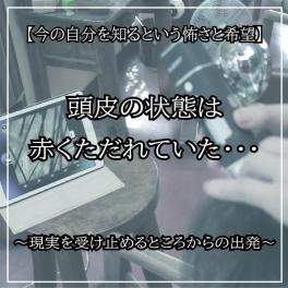 浜松市の美容室「マイクロスコープ・頭皮チェック」現実を受け止めるところから